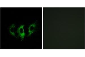 Immunofluorescence analysis of A549 cells, using GFM2 Antibody.