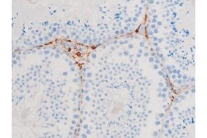 Image no. 7 for anti-Spleen tyrosine Kinase (SYK) (pTyr348) antibody (ABIN6255895)