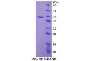 Image no. 1 for Prostaglandin-Endoperoxide Synthase 2 (Prostaglandin G/H Synthase and Cyclooxygenase) (PTGS2) (AA 187-425) protein (His tag) (ABIN1878555)