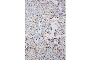 Image no. 1 for anti-Amyloid P Component, Serum (APCS) (AA 21-224) antibody (ABIN3042514)