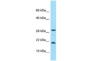 Image no. 1 for anti-Crystallin, gamma N (CRYGN) (C-Term) antibody (ABIN2790620)