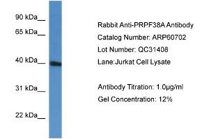 Image no. 2 for anti-PRP38 Pre-mRNA Processing Factor 38 (Yeast) Domain Containing A (PRPF38A) (C-Term) antibody (ABIN2774293)