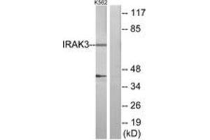 Image no. 1 for anti-Interleukin-1 Receptor-Associated Kinase 3 (IRAK3) (AA 491-540) antibody (ABIN1534222)