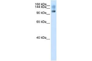 Image no. 1 for anti-Splicing Factor, Suppressor of White-Apricot Homolog (SFSWAP) (N-Term) antibody (ABIN629997)