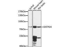 ENTPD4 Antikörper  (AA 350-470)