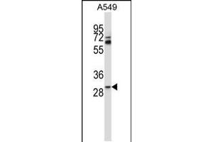 TATDN1 抗体  (AA 115-143)