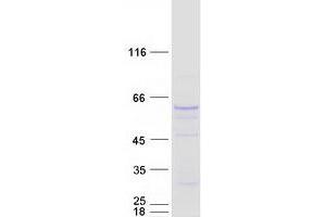 Image no. 1 for Spermine Oxidase (SMOX) (Transcript Variant 2) protein (Myc-DYKDDDDK Tag) (ABIN2732257)
