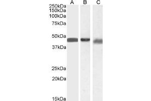 Image no. 3 for anti-Arrestin, beta 2 (ARRB2) (Internal Region) antibody (ABIN185395)
