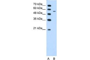 anti-Carbohydrate (N-Acetylglucosamine 6-O) Sulfotransferase 7 (CHST7) (Middle Region) antibody