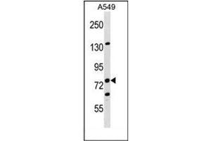 Image no. 1 for anti-LIM Domain and Actin Binding 1 (LIMA1) (AA 134-163), (N-Term) antibody (ABIN953171)