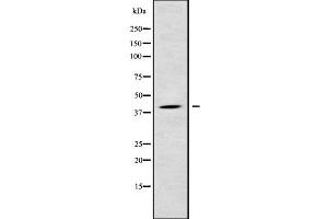 Image no. 1 for anti-Lysophosphatidylglycerol Acyltransferase 1 (LPGAT1) antibody (ABIN6262998)