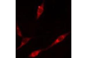 Image no. 3 for anti-Promyelocytic Leukemia (PML) (N-Term) antibody (ABIN6264315)
