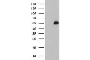 Image no. 1 for anti-Tubby Like Protein 3 (TULP3) antibody (ABIN1501586)