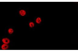 Image no. 2 for anti-Histone Deacetylase 5 (HDAC5) (pSer498) antibody (ABIN6255378)