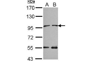 Image no. 2 for anti-N(alpha)-Acetyltransferase 15, NatA Auxiliary Subunit (NAA15) (C-Term) antibody (ABIN1491819)