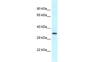 Image no. 1 for anti-Fibronectin Type III and SPRY Domain Containing 1-Like (FSD1L) (C-Term) antibody (ABIN2788498)