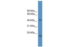 Image no. 1 for anti-Saccharopine Dehydrogenase (SCCPDH) (Middle Region) antibody (ABIN928699)