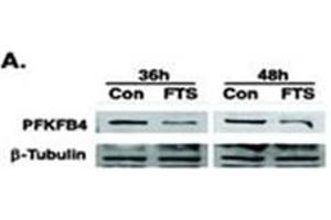 Image no. 2 for anti-6-phosphofructo-2-Kinase/fructose-2,6-Biphosphatase 4 (PFKFB4) (AA 274-303) antibody (ABIN360670)