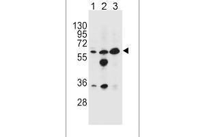 Image no. 1 for anti-Glycine Amidinotransferase (L-Arginine:glycine Amidinotransferase) (GATM) (AA 58-84), (N-Term) antibody (ABIN654401)