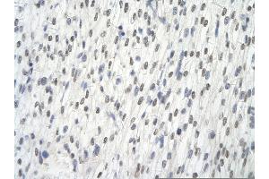 AARS anticorps  (C-Term)