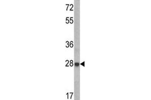 Image no. 1 for anti-Insulin-Like Growth Factor Binding Protein 6 (IGFBP6) (AA 176-200) antibody (ABIN3031358)