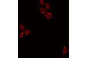 Image no. 2 for anti-CD70 Molecule (CD70) (Internal Region) antibody (ABIN6260645)