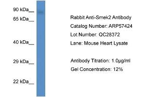 Image no. 1 for anti-SMEK Homolog 2, Suppressor of Mek1 (Dictyostelium) (SMEK2) (C-Term) antibody (ABIN2787220)