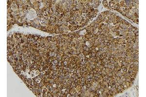ABIN6279131 at 1/100 staining Human pancreas tissue by IHC-P.