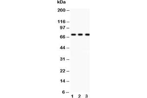 Image no. 3 for anti-Tumor Protein P73 (TP73) (AA 1-198) antibody (ABIN3029401)