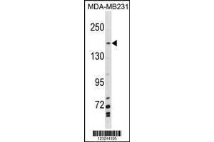 Image no. 1 for anti-Myb-Binding Protein 1A (MYBBP1A) (AA 258-287), (N-Term) antibody (ABIN1881560)
