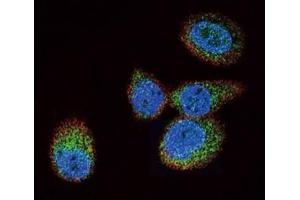 Image no. 6 for anti-HRas proto-oncogene, GTPase (HRAS) (AA 104-128) antibody (ABIN3029525)