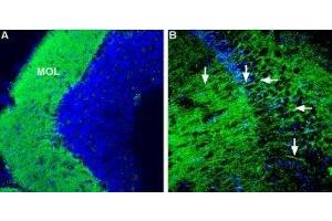 Expression of Corticotropin-releasing factor receptor 1 in mouse brain - Immunohistochemical staining of mouse hippocampus and mouse cerebellum using Anti-CRF1/CRHR1 (extracellular) Antibody (ABIN7043086, ABIN7044185 and ABIN7044186), (1:600).