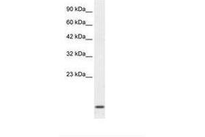 Image no. 2 for anti-Homeobox A1 (HOXA1) (C-Term) antibody (ABIN202024)