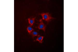 Image no. 1 for anti-Collagen, Type IV, alpha 5 (COL4A5) (N-Term) antibody (ABIN2707439)