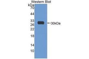 Image no. 4 for Antigen Identified By Monoclonal Antibody Ki-67 (MKI67) ELISA Kit (ABIN6720578)