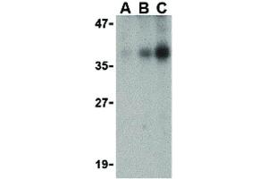 Image no. 1 for anti-DNA Fragmentation Factor, 40kDa, beta Polypeptide (Caspase-Activated DNase) (DFFB) (Internal Region) antibody (ABIN6656652)