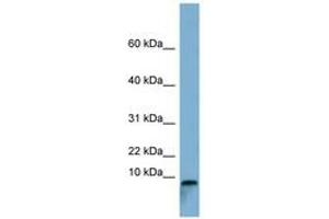 Image no. 1 for anti-T-Cell Leukemia Translocation Altered (TCTA) (C-Term) antibody (ABIN6741765)