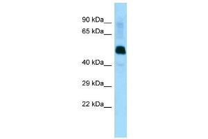Image no. 1 for anti-Leucine Rich Repeat (In FLII) Interacting Protein 1 (LRRFIP1) (Middle Region) antibody (ABIN2776427)