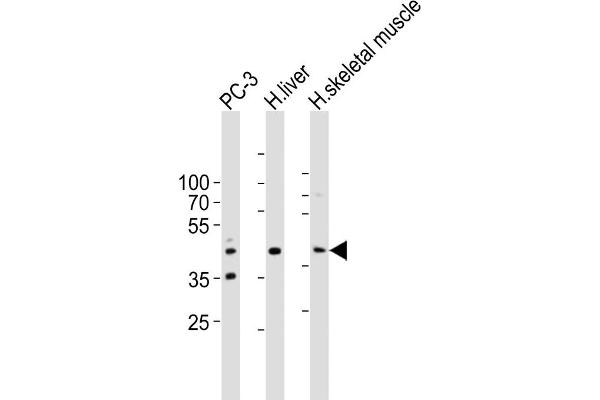 POC1A antibody  (C-Term)