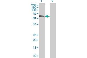 Western Blot analysis of ZNF394 expression in transfected 293T cell line by ZNF394 MaxPab polyclonal antibody.