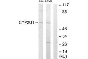 Image no. 1 for anti-Cytochrome P450, Family 2, Subfamily U, Polypeptide 1 (CYP2U1) (AA 281-330) antibody (ABIN1534392)