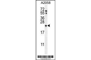 Image no. 1 for anti-RAB10, Member RAS Oncogene Family (RAB10) (AA 89-117) antibody (ABIN656106)