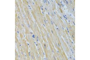 Image no. 7 for anti-Non-Metastatic Cells 1, Protein (NM23A) Expressed in (NME1) (C-Term) antibody (ABIN3020815)