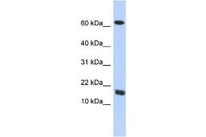 anti-Chromosome 4 Open Reading Fram 46 (C4orf46) (Middle Region) antibody