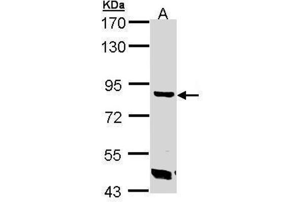 TREH anticorps  (Center)