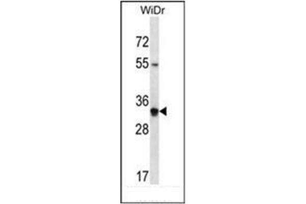OR2W5 antibody  (C-Term)