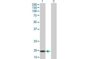 Western Blot analysis of VSTM2L expression in transfected 293T cell line by VSTM2L MaxPab polyclonal antibody.