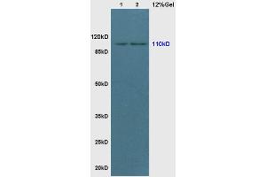 Image no. 1 for anti-Phosphoinositide-3-Kinase, Catalytic, alpha Polypeptide (PIK3CA) (pTyr317) antibody (ABIN711521)
