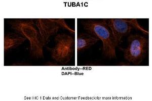 Image no. 3 for anti-Tubulin, alpha 1c (TUBA1C) (C-Term) antibody (ABIN2788514)