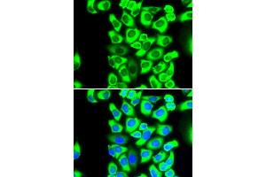 Image no. 5 for anti-Ribosomal Protein S3A (RPS3A) antibody (ABIN6147221)